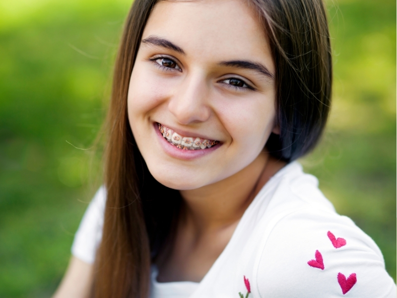 Girl smiling in colored braces