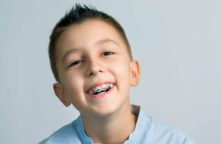 Smiling boy with dental braces