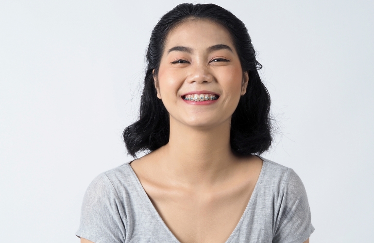 Smiling woman with orthodontic braces.