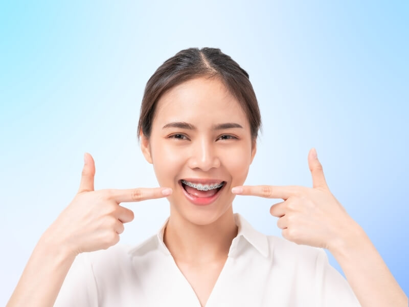 Woman smiling with braces, pointing at her teeth