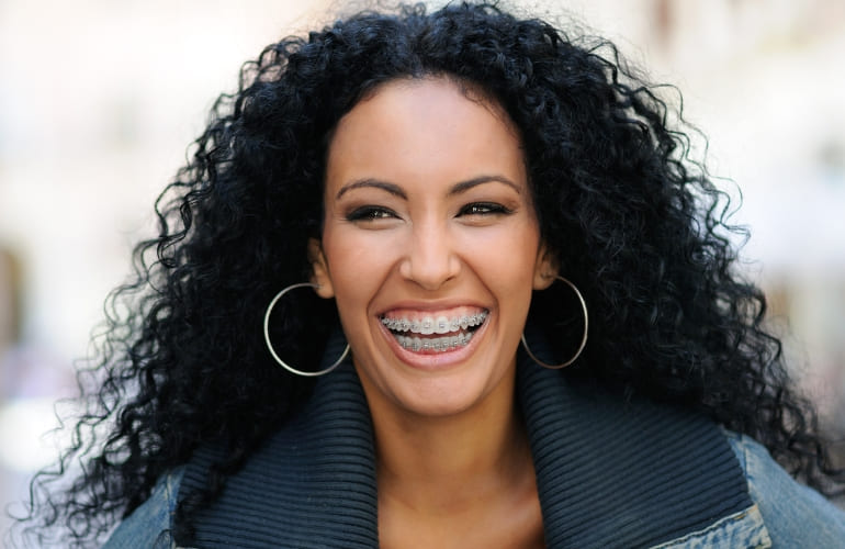 Woman smiling with dental braces